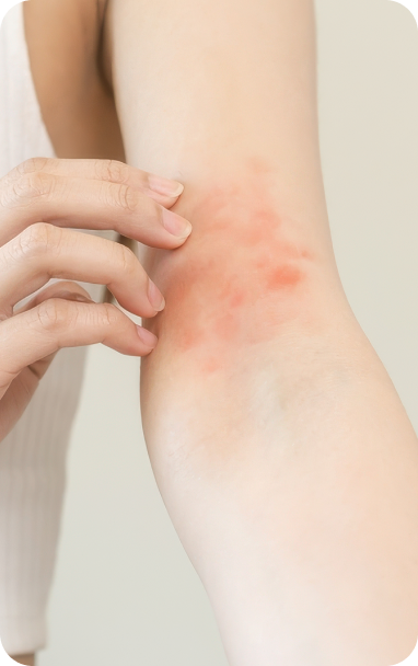 bibiotic derma helps